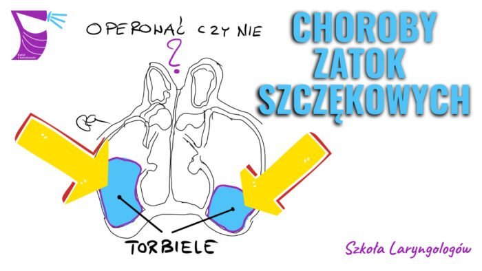 Które choroby zatok szczękowych wymagają leczenia? Operacja, czy leczenie zachowawcze? - środa, 26 stycznia 2022, godz. 21:00 - webinar z laryngologiem dr Piotrem Hadrowiczem