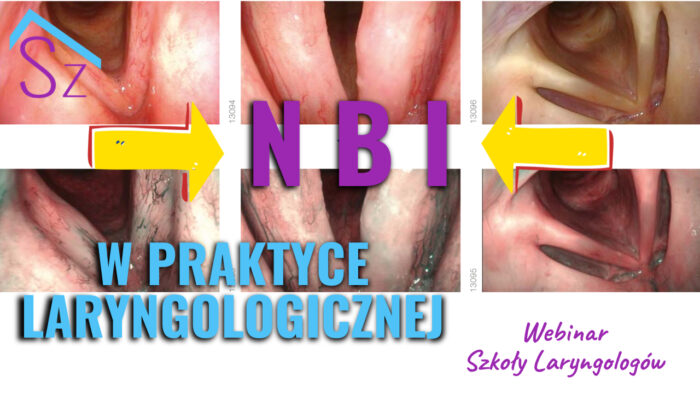 NBI (narrow band imaging) w praktyce laryngologicznej - webinar Szkoły Laryngologów, środa 16 lutego o godz. 21:00 - ekspert - dr Aleksandra Sobolewska, Kraków