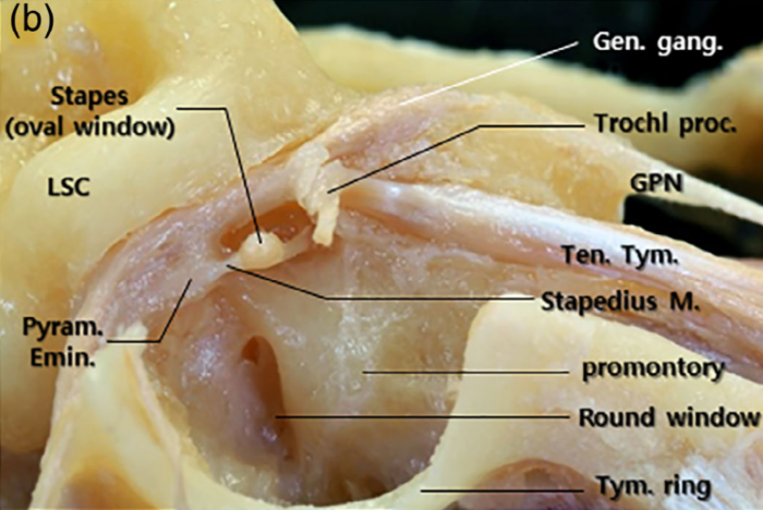 Mikroanatomia nerwu twarzowego - webinar Szkoły Laryngologów, środa 21 września 2022, godz. 21:00 - dr Rafał Chmielewski - obrazek 3