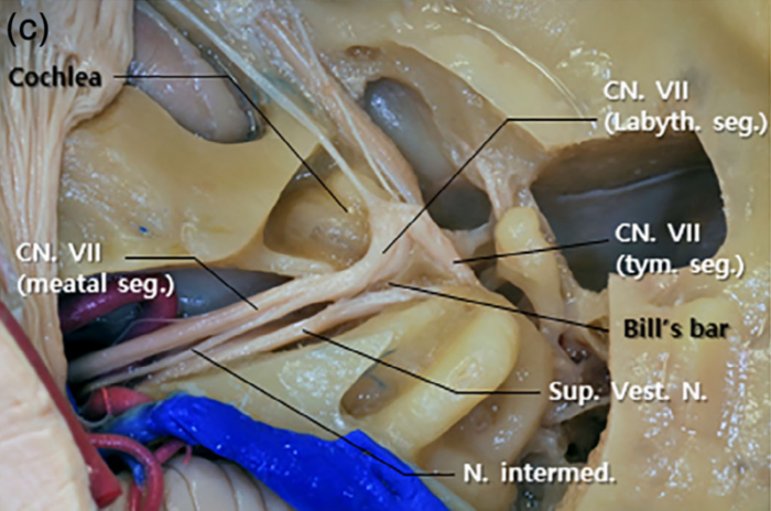 Mikroanatomia nerwu twarzowego - webinar Szkoły Laryngologów, środa 21 września 2022, godz. 21:00 - dr Rafał Chmielewski - obrazek 2