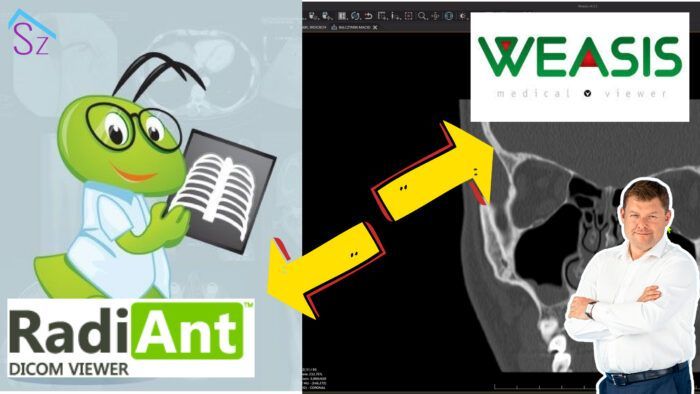 Obsługa programów do oceny badań obrazowych - Radiant i Weasis, szkolenie Szkoły Laryngologów - Rafał Chmielewski