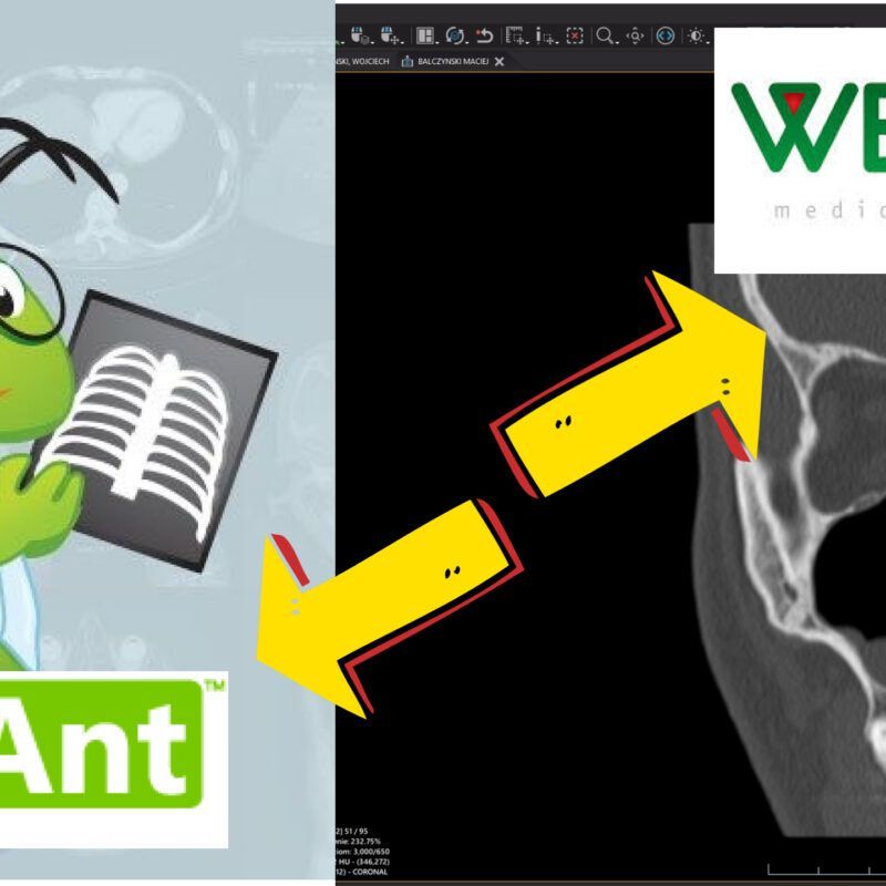 Obsługa programów do oceny badań obrazowych - Radiant i Weasis, szkolenie Szkoły Laryngologów - Rafał Chmielewski