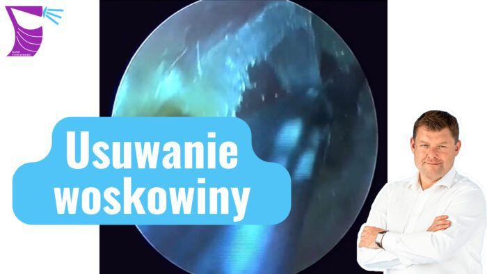Indywidualne szkolenie stacjonarne - zasady bezpiecznego usuwania woskowiny (1 godzina)