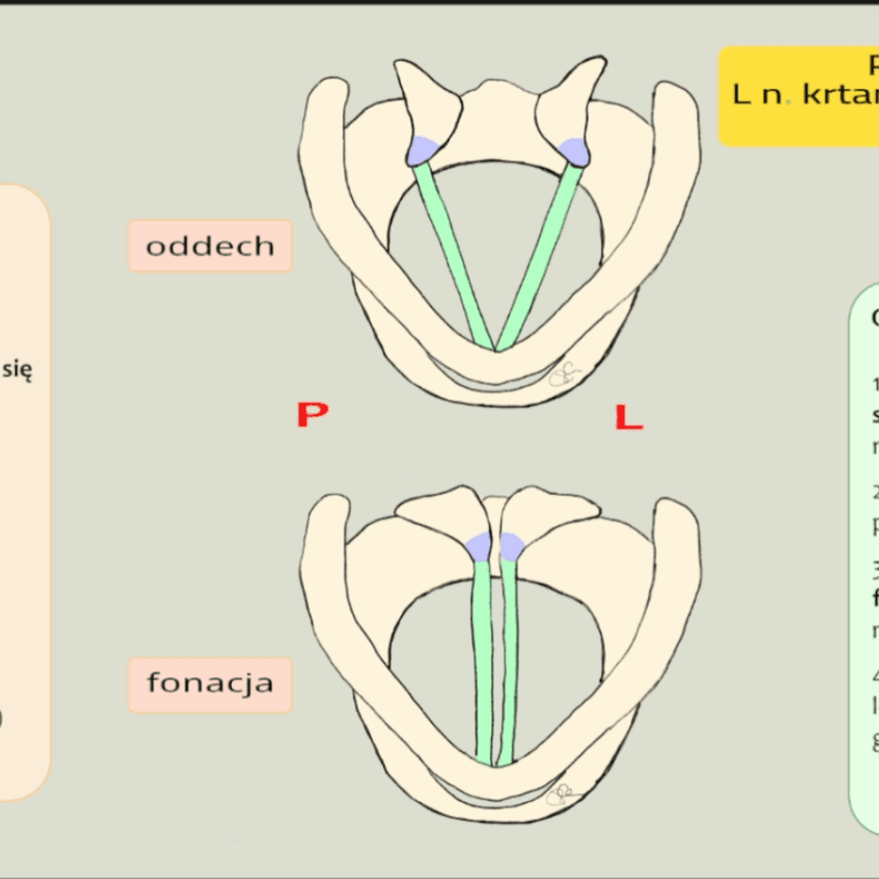 Porażenia krtani - objawy, obrazy krtani w endoskopii i schematy na ścianę - webinar Szkoły Laryngologów - dr Rafał Chmielewski